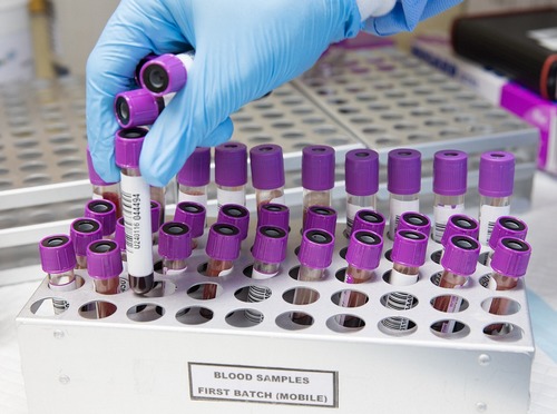 Photo montrant échantillons de tests médicaux pour covid-19, mis en pack en laboratoire.